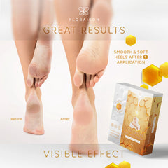 FOOT PEEL MASK HONEY