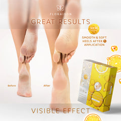 FOOT PEEL MASK VITAMIN C
